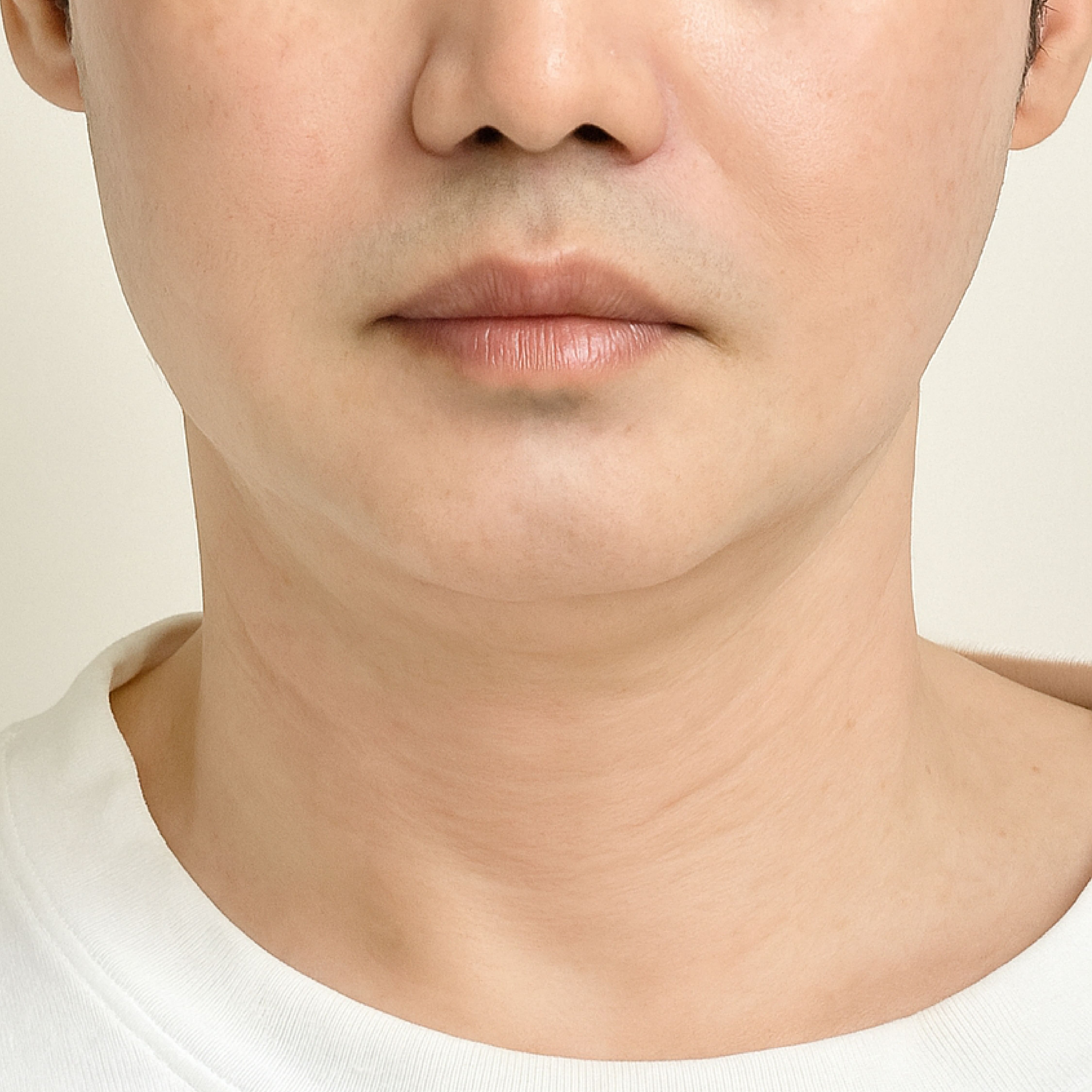 After