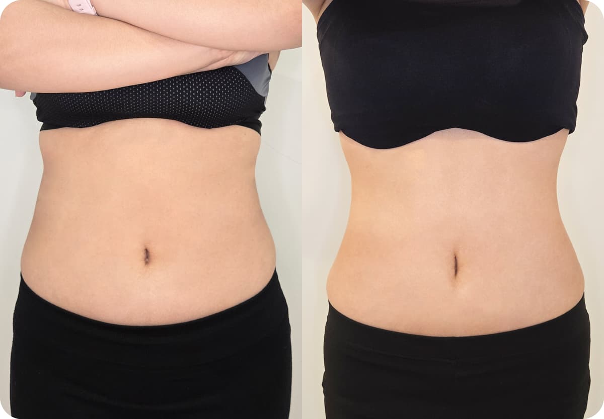 before-after-1