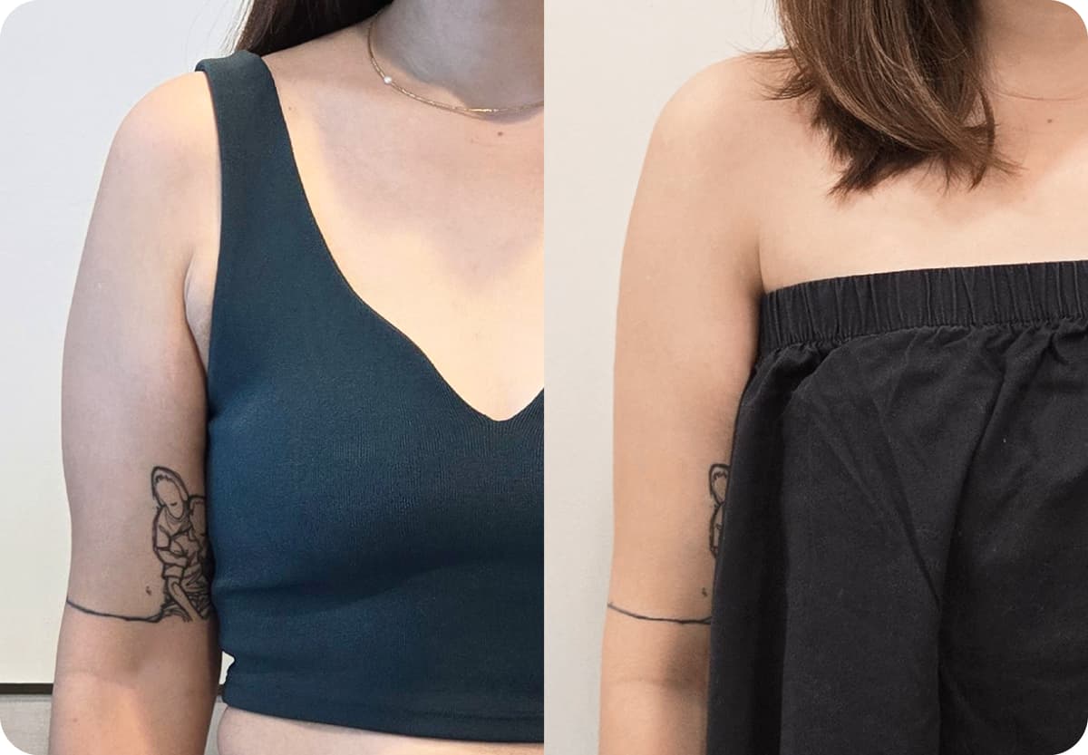 before-after-2