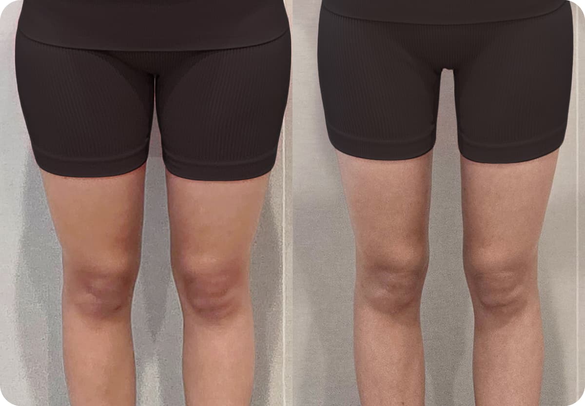 before-after-3