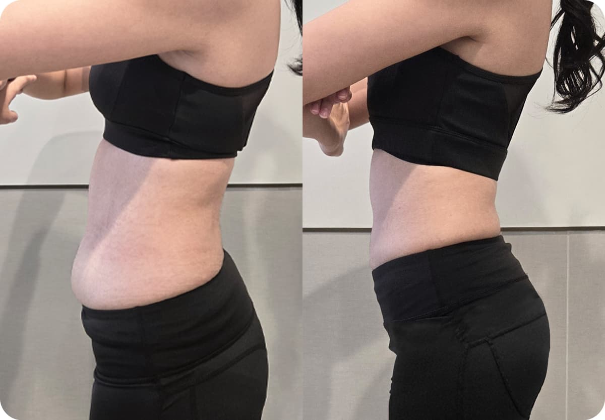 before-after-4